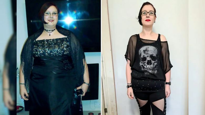 Woman Before And After Losing 118 Pounds